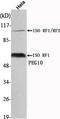 EDR antibody, M03240, Boster Biological Technology, Western Blot image 