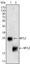 Myosin Light Chain 2 antibody, MA5-15496, Invitrogen Antibodies, Western Blot image 