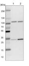 Exocyst Complex Component 2 antibody, NBP1-83786, Novus Biologicals, Western Blot image 