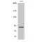 Microtubule Affinity Regulating Kinase 2 antibody, LS-C384431, Lifespan Biosciences, Western Blot image 