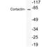 Cortactin antibody, LS-C199818, Lifespan Biosciences, Western Blot image 