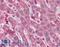 Hyaluronidase 1 antibody, LS-B2612, Lifespan Biosciences, Immunohistochemistry paraffin image 