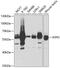 Asparagine Synthetase (Glutamine-Hydrolyzing) antibody, GTX30068, GeneTex, Western Blot image 