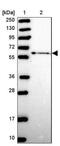 Zinc Finger Protein 530 antibody, NBP2-13580, Novus Biologicals, Western Blot image 