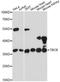 Tubulin Folding Cofactor B antibody, A13248, ABclonal Technology, Western Blot image 