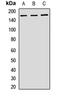 Proline, Glutamate And Leucine Rich Protein 1 antibody, LS-C668638, Lifespan Biosciences, Western Blot image 