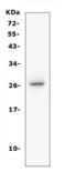 CD160 Molecule antibody, A06168-1, Boster Biological Technology, Western Blot image 