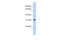 3-Hydroxyisobutyrate Dehydrogenase antibody, 26-744, ProSci, Western Blot image 