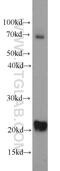 Twist-related protein 2 antibody, 11752-1-AP, Proteintech Group, Western Blot image 
