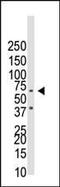 CDw293 antibody, PA5-11860, Invitrogen Antibodies, Western Blot image 