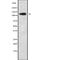 Ubiquitination Factor E4A antibody, abx219216, Abbexa, Western Blot image 