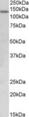 Lysine Demethylase 2A antibody, LS-B8683, Lifespan Biosciences, Western Blot image 