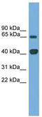 LIM Homeobox Transcription Factor 1 Alpha antibody, TA329966, Origene, Western Blot image 