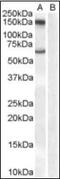 Monoamine Oxidase B antibody, orb88524, Biorbyt, Western Blot image 