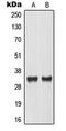 MAX Dimerization Protein MLX antibody, MBS821973, MyBioSource, Western Blot image 