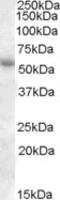 IKAROS Family Zinc Finger 1 antibody, 42-736, ProSci, Western Blot image 