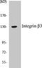 Integrin Subunit Beta 3 antibody, EKC1304, Boster Biological Technology, Western Blot image 