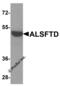 C9orf72-SMCR8 Complex Subunit antibody, 8469, ProSci, Western Blot image 