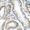 TNF Superfamily Member 10 antibody, LS-C331936, Lifespan Biosciences, Immunohistochemistry paraffin image 