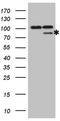 Matrix Metallopeptidase 2 antibody, LS-C340120, Lifespan Biosciences, Western Blot image 