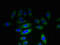 KH Domain Containing 1 antibody, CSB-PA709298LA01HU, Cusabio, Immunofluorescence image 