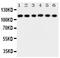 Matrilin 2 antibody, PA1926, Boster Biological Technology, Western Blot image 