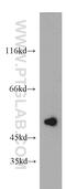 TNFAIP3 Interacting Protein 2 antibody, 15459-1-AP, Proteintech Group, Western Blot image 