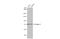 Epsin 2 antibody, GTX118330, GeneTex, Western Blot image 