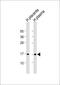 Transthyretin antibody, A00290, Boster Biological Technology, Western Blot image 