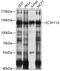 Zinc Finger CCCH-Type Containing 11A antibody, 13-396, ProSci, Western Blot image 