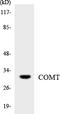 Catechol-O-Methyltransferase antibody, LS-C291826, Lifespan Biosciences, Western Blot image 