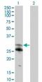 NFAT Activating Protein With ITAM Motif 1 antibody, TA337088, Origene, Western Blot image 