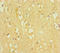TOX High Mobility Group Box Family Member 3 antibody, LS-C679863, Lifespan Biosciences, Immunohistochemistry paraffin image 