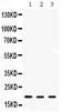 ADP Ribosylation Factor 6 antibody, PB9987, Boster Biological Technology, Western Blot image 