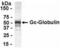GC Vitamin D Binding Protein antibody, XW-7702, ProSci, Immunohistochemistry paraffin image 