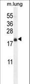 Transmembrane Protein 80 antibody, LS-C162022, Lifespan Biosciences, Western Blot image 