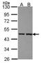 Zinc Finger Protein 396 antibody, NBP2-21004, Novus Biologicals, Western Blot image 