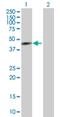 Cytochrome P450 Family 26 Subfamily A Member 1 antibody, H00001592-B01P, Novus Biologicals, Western Blot image 