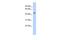 Ectonucleotide Pyrophosphatase/Phosphodiesterase 6 antibody, GTX45607, GeneTex, Western Blot image 