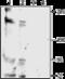 Potassium Sodium-Activated Channel Subfamily T Member 2 antibody, GTX16699, GeneTex, Western Blot image 