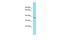 YdjC Chitooligosaccharide Deacetylase Homolog antibody, A16205, Boster Biological Technology, Western Blot image 