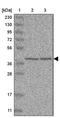 Uroporphyrinogen Decarboxylase antibody, PA5-55630, Invitrogen Antibodies, Western Blot image 