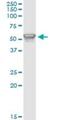 Phosphoinositide-3-Kinase Regulatory Subunit 1 antibody, H00005295-M01, Novus Biologicals, Immunoprecipitation image 