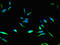 Cyclin Dependent Kinase Inhibitor 2B antibody, LS-C396118, Lifespan Biosciences, Immunofluorescence image 