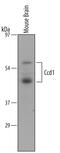 DIX Domain Containing 1 antibody, PA5-48086, Invitrogen Antibodies, Western Blot image 