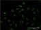 Inhibitor Of Nuclear Factor Kappa B Kinase Subunit Beta antibody, H00003551-M08, Novus Biologicals, Immunofluorescence image 