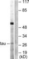 Tyrosine 3-Monooxygenase/Tryptophan 5-Monooxygenase Activation Protein Theta antibody, LS-C117785, Lifespan Biosciences, Western Blot image 