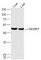 Sterol Regulatory Element Binding Transcription Factor 1 antibody, GTX03277, GeneTex, Western Blot image 