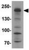 Shroom Family Member 3 antibody, GTX32099, GeneTex, Western Blot image 