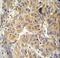 Asparaginyl-TRNA Synthetase antibody, LS-C164748, Lifespan Biosciences, Immunohistochemistry paraffin image 